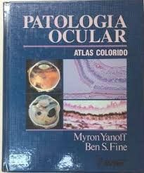 Patologia Ocular Atlas Colorido