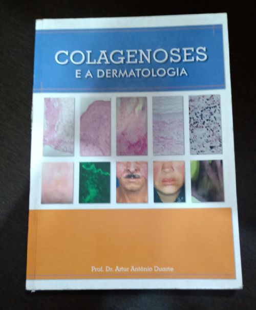 Colagenoses e a Dermatologia