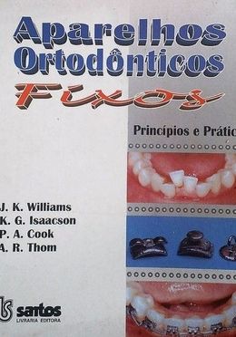 Aparelhos Ortodonticos Fixos