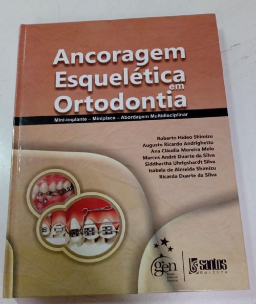 Ancoragem esquelética em ortodontia
