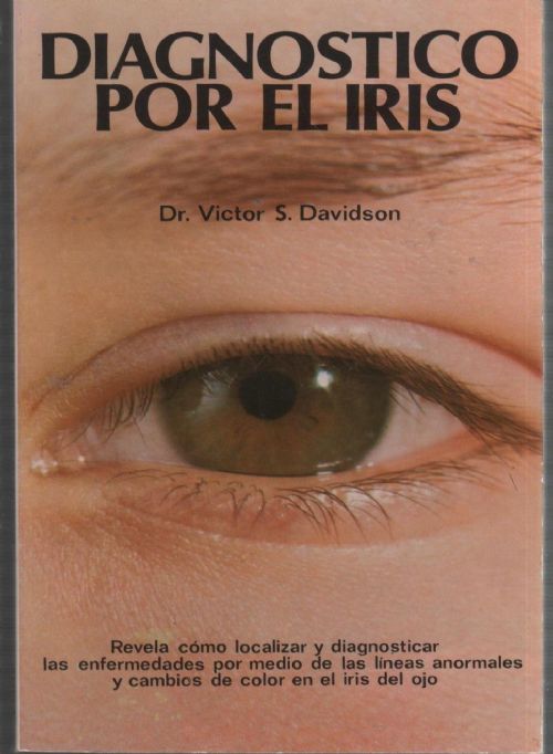 Diagnóstico por El Iris