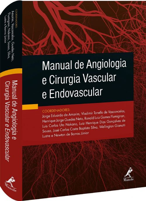 Manual de Angiologia e Cirurgia Vascular e Endovascular