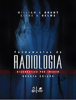 Fundamentos de Radiologia - Diagnóstico por Imagem